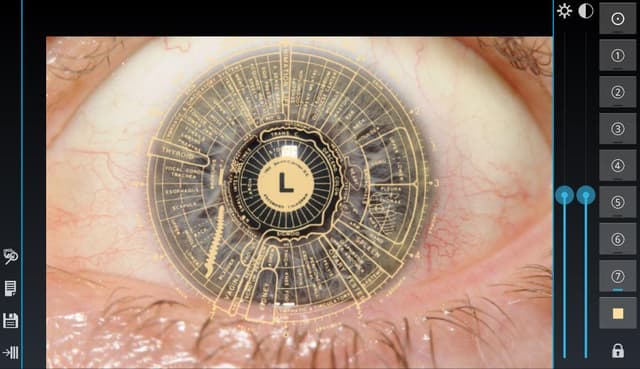 Eye Diagnosis screenshot 6