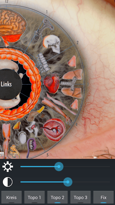 Eye Diagnosis screenshot 4