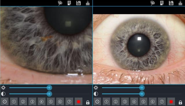 Eye Diagnosis screenshot 5