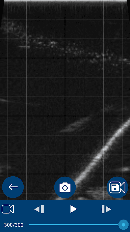 IMV Go Scan screenshot 4