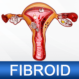 Uterine Fibroid Treatment Help icon