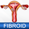 Uterine Fibroid Treatment Help का आइकन